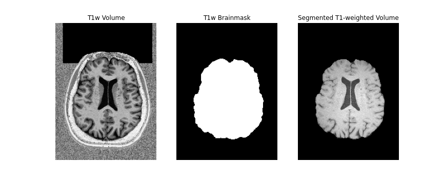 T1w brainmask