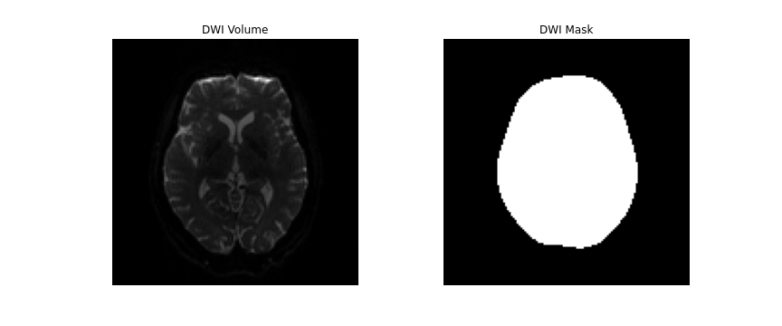 b0 brainmask