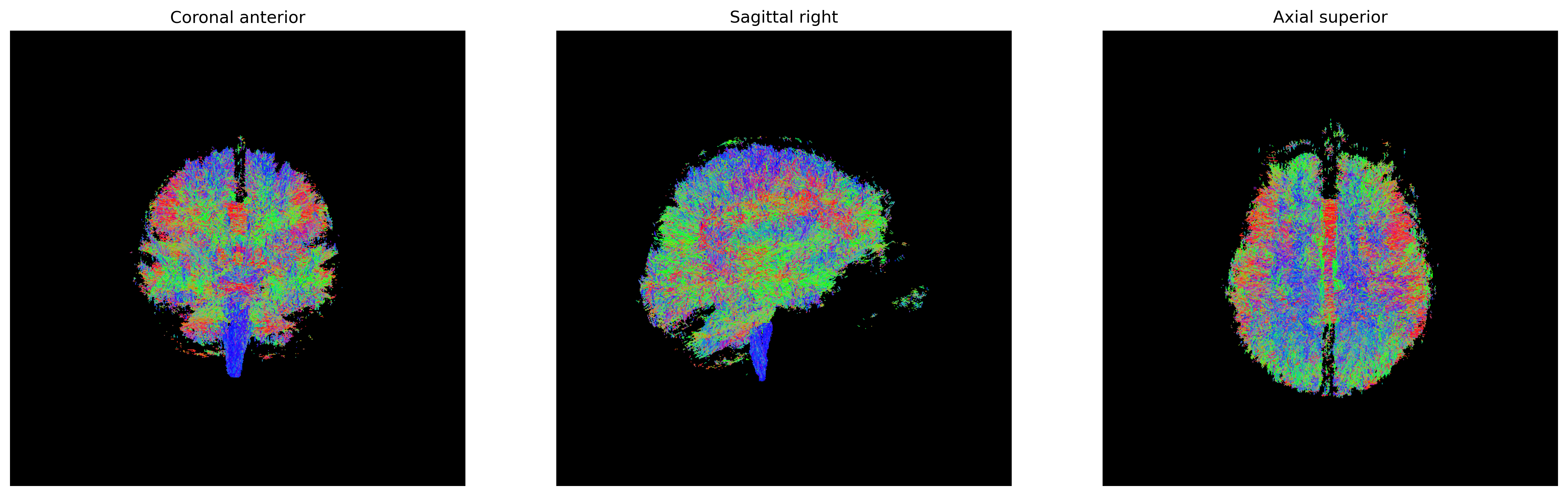 PMF direction getter-derived probabilistic tractogram