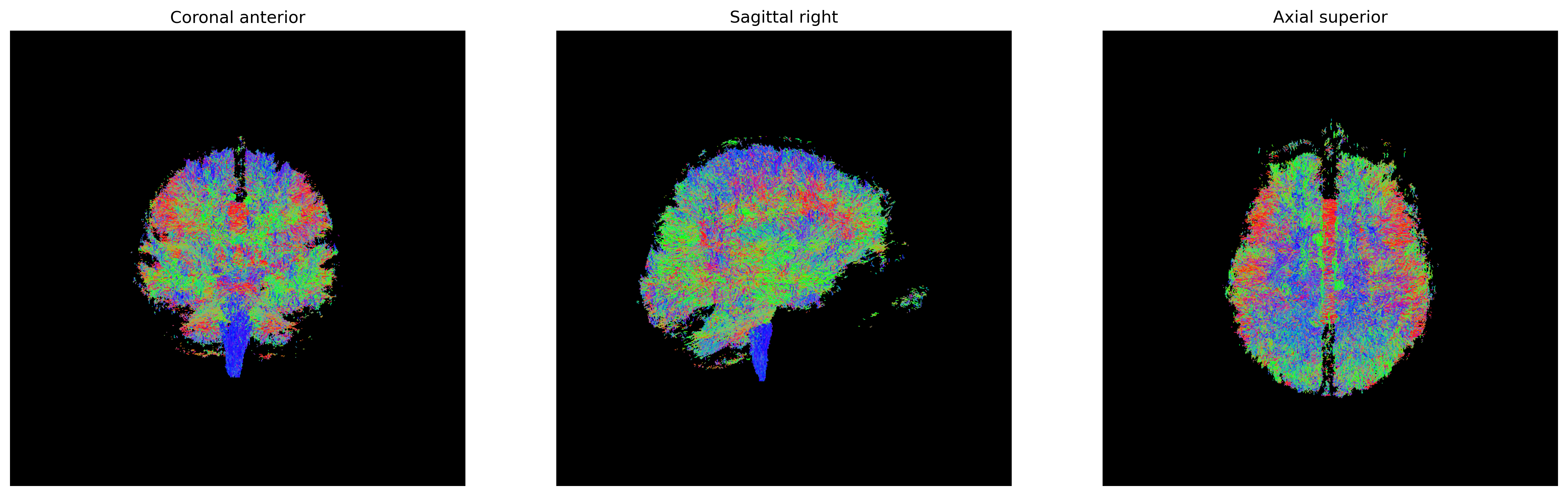 SH direction getter-derived probabilistic tractogram